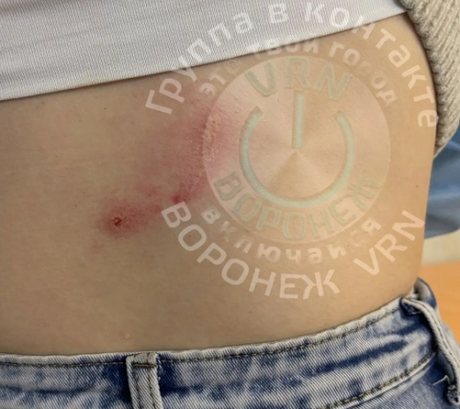 Сбили с ног, искусали и порвали одежду: стая собак напала на жительницу Воронежа