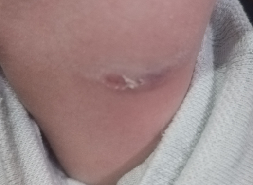 Домашняя собака пыталась загрызть школьницу в посёлке под Воронежем