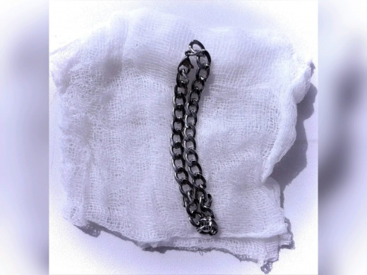 В Воронеже ребёнок случайно проглотил 20-сантиметровую цепочку