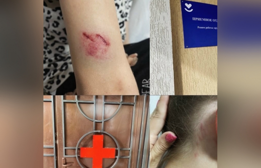 Прыгала, рычала, кусалась: в воронежском райцентре искали собаку, напавшую на двух девочек