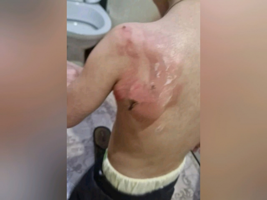 В отделе образования прокомментировали ожог ребёнка в воронежском детском саду