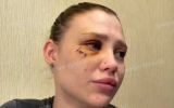 Полиция нашла воронежца, который жестоко избил девушку у караоке