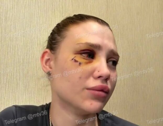 Полиция нашла воронежца, который жестоко избил девушку у караоке
