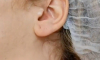 В Москве стали популярны инъекции в точку голода на ухе ради похудения