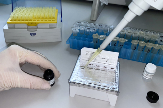 Забелин: У одного пациента Домодедовской больницы подтвердили оспу обезьян