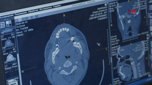 Воронежец, изуродовавший лицо, катаясь на электросамокате, рассказал о злополучной поездке