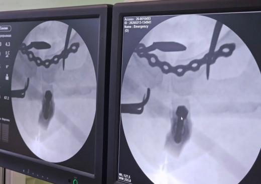 Жительница Воронежа раздробила таз, катаясь на тюбинге