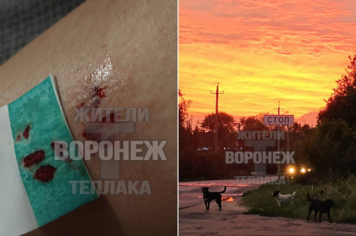 Стая собак покусала девушку в Воронеже
