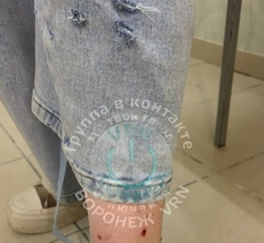 В Воронеже не поймали собак, искусавших девушку у института МВД