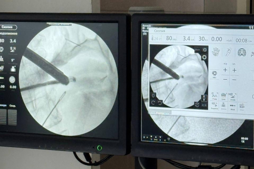 В Красногорске врачи спасли проглотившую иголки женщину