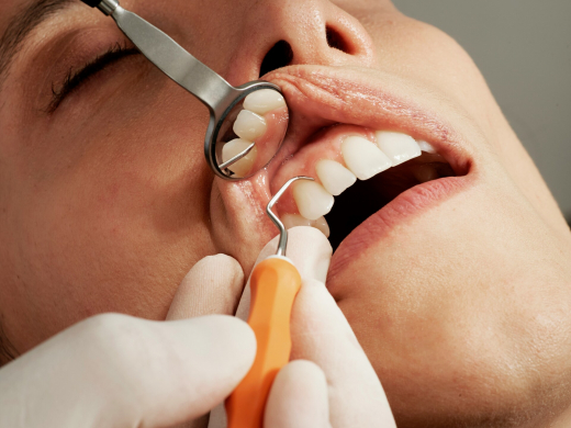 Стоматолог Тумашевич: отсутствие профгигиены одна причин запаха изо рта