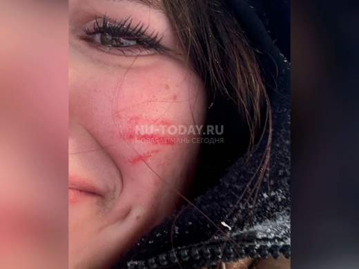 Травму лица получила девушка при спуске с платной горки под Воронежем