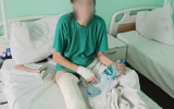 В Воронеже избитая сожителем женщина попала в приют для бездомных