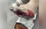 Очевидец: пожилая женщина серьезно повредила ногу после падения в воронежском автобусе
