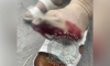 Очевидец: пожилая женщина серьезно повредила ногу после падения в воронежском автобусе